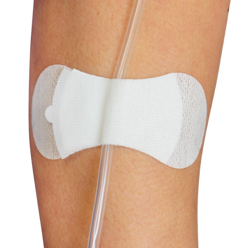 TIDI 3300M-10PK Grip-Lok Medium Securement Device ― Pack of 10 ― Catheter Stabilization Device ― White ― Low-Profile Design for Comfort― Home Healthcare ― FSA Eligible Medical Supplies - Image 1